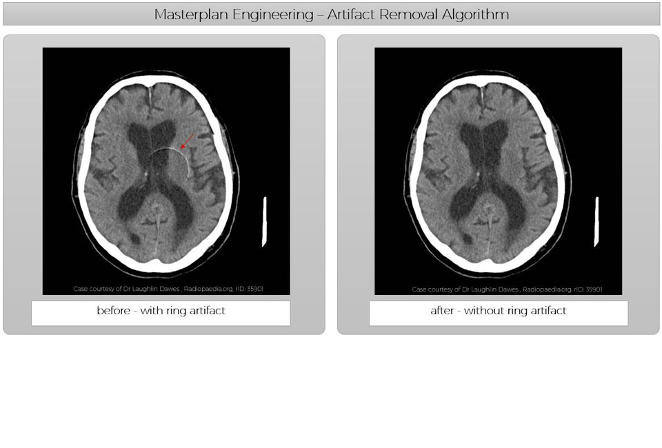 Remove Artifact Algorithm